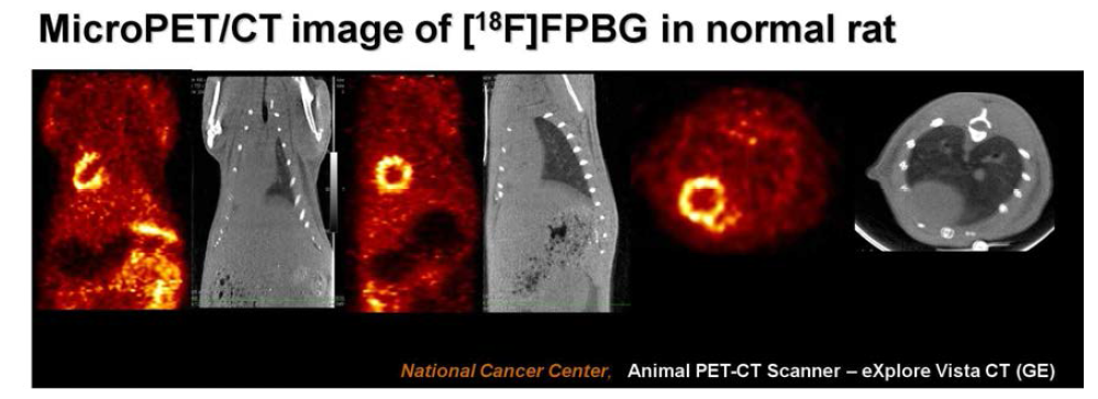 F-18 Guanidine의 microPET/CT 영상