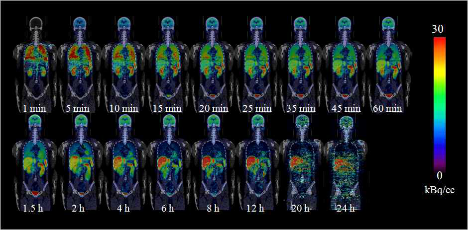 Haloperidol whole body PK studies using F-18 HAL