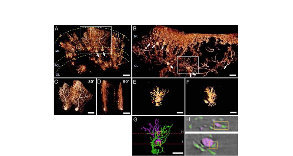 정상과 reeler 모델 쥐의 소뇌 조직 및 퍼킨제 세포의 3차원 영상
