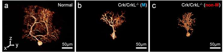 신경세포(Purkinje Cell, PC)의 3차원 마이크로 토모그래피 영상