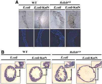 ROS 저항성균이 NF-kB mutant Drosophila의 장내 침입 했을 때 심각한 장 상피 조직의 손상을 야기한다.