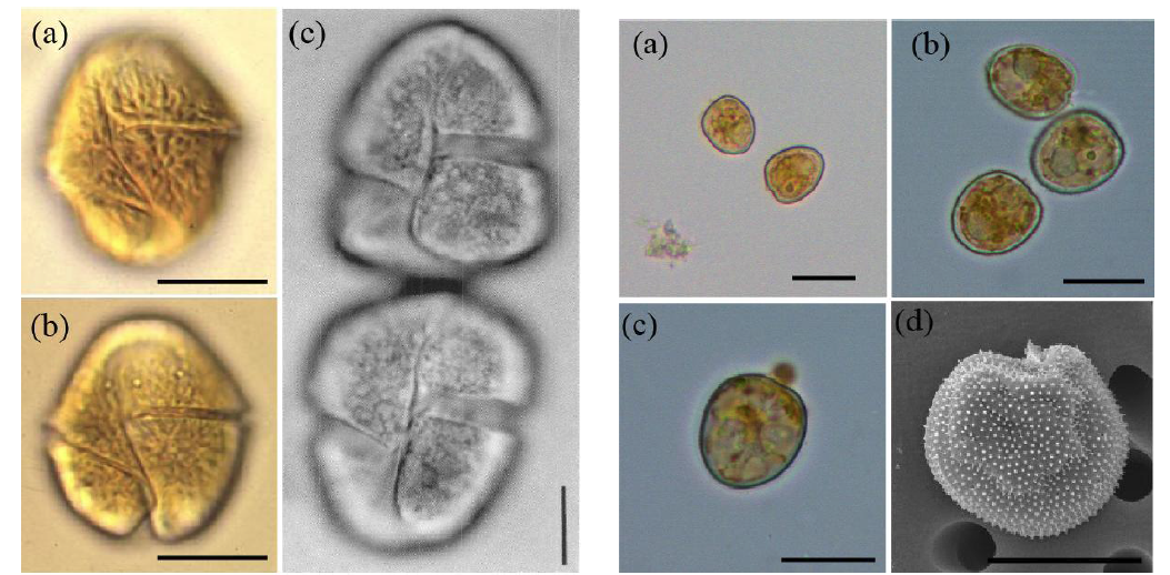 연구에 사용한 무각 와편모조류 Gymnodinium impudicum(왼쪽 판넬) Prorocentrum minimum (D-127; 오른쪽 판넬)현미경 사진.