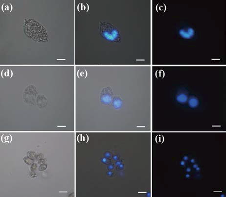 와편모조류 Prorocentrum micans (a-c), Cochlodinium polykrikoides (d-e), and Prorocentrum minimum (g-i)의 광학현미경 및 DAPI 형광이미지.Scale bar= 10 μm.