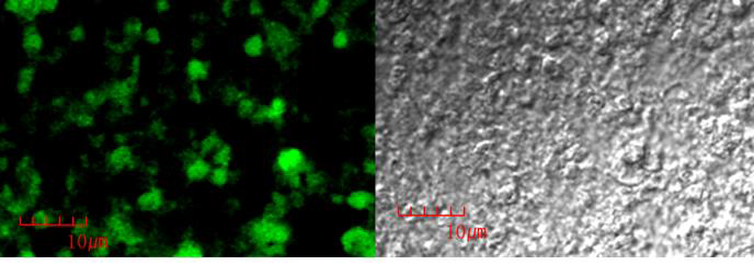 CD3 kidney