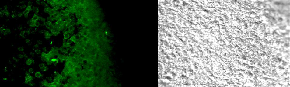 CD3 poly spleen