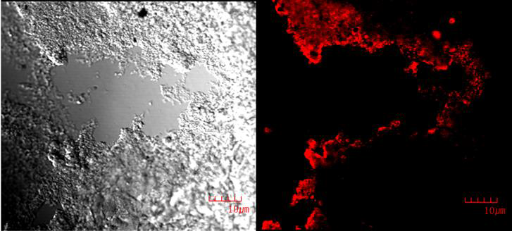 CD200 liver