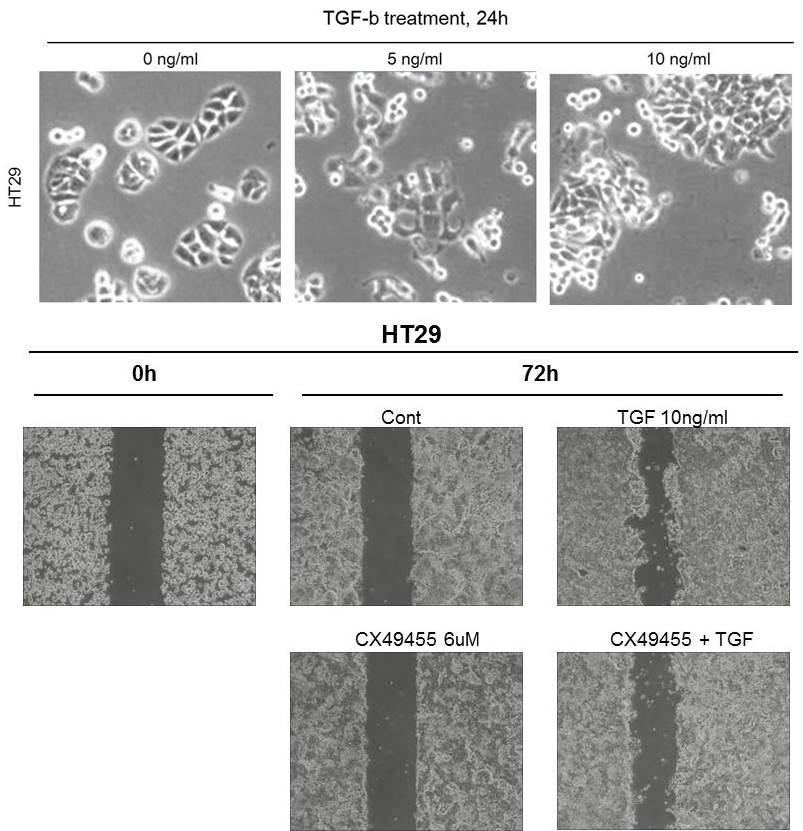 TGF-β 처리에 의한 phenotype 변화 및 CK2의 매개