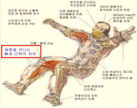 우주비행을 마친 우주인에게 나타나는 신체적인 증상