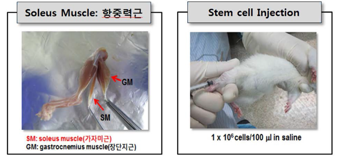 가자미근(soleus muscle)에 줄기세포 이식 모습.