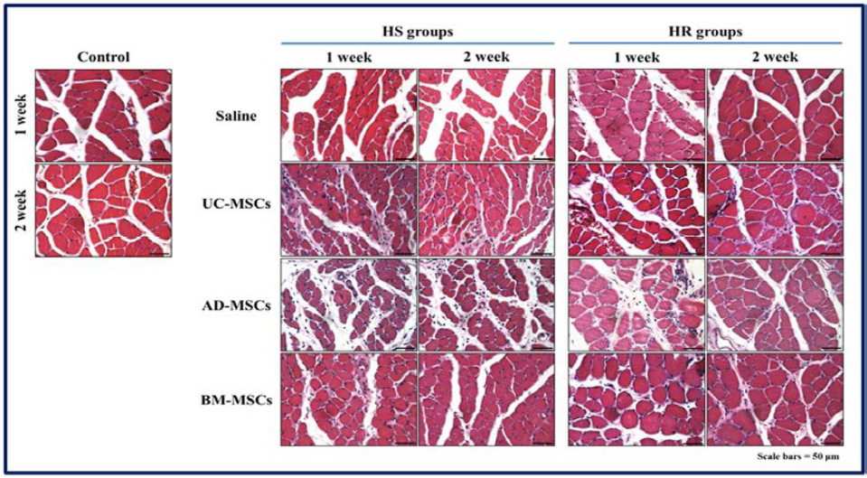 이식된 줄기세포 종류에 따른 가자미근의 근섬유 단면적 비교 (H&E stain)
