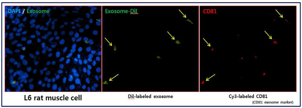 근육세포로의 엑소좀 전달
