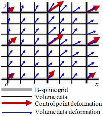 B-스플라인 변형 모델에 의한 전체 볼륨 데이터의 변형
