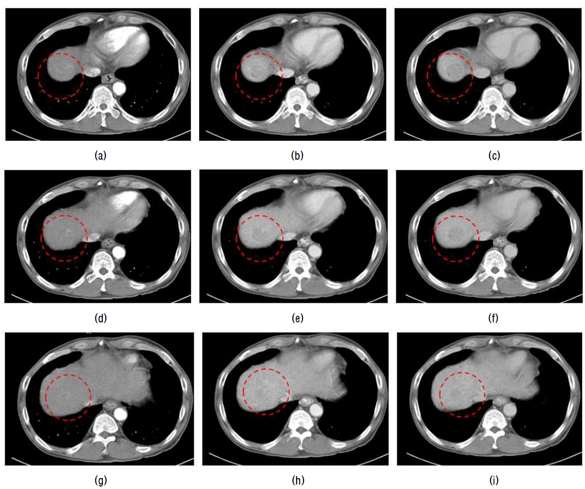 다중 페이즈 CT 영상에 제안 기법의 적용 결과.