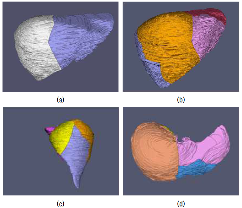 2-part / 4-part liver segment division 결과 (a) 2-part division (b),(c),(d) 4-part division