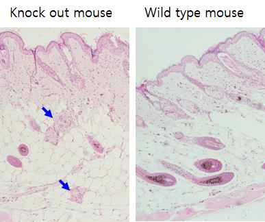 Hair follicular dystruction in CD80CD86 KO