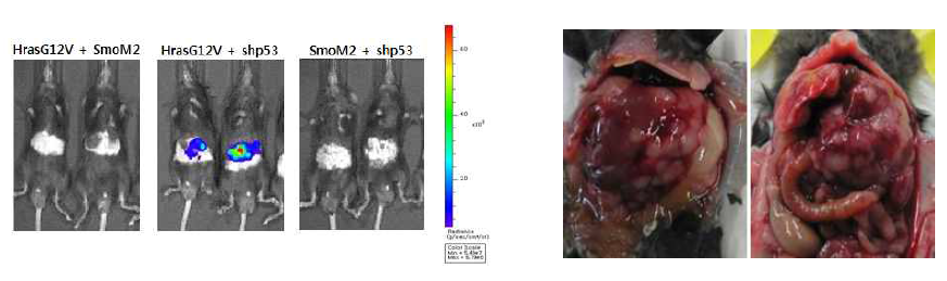 Bioluminescence imaging (왼쪽) 와 HrasG12V + shp53 모델에서 liver cancer 확인 (오른쪽)