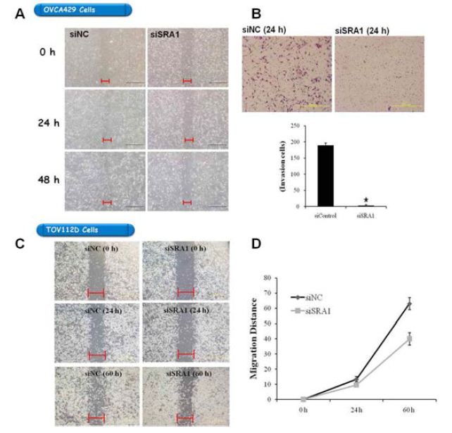 siSRA의 migration과 invasion 변화