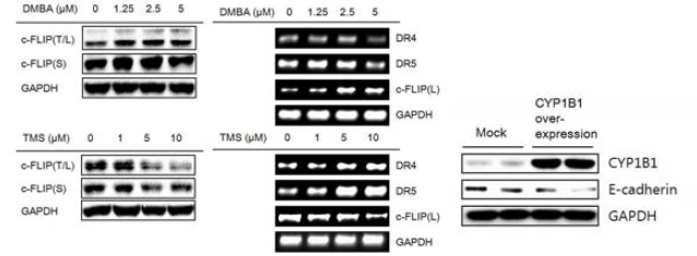 CYP1B1의 EMT 유도