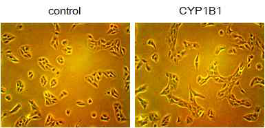 CYP1B1에 의한 morphological change