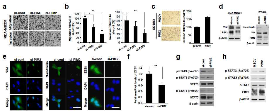 Pim2에 의한 유방암세포의 상피성-중간엽성 세포전이와 전이능 획득 규명