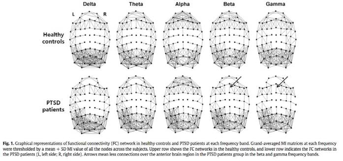 PTSD 환자군과 건강인 대조군의 뇌전도 주파수 대역 별 전극 간 네트워크 비교.