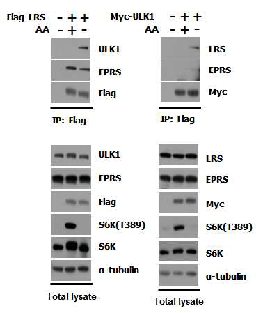 ULK1과 LRS의 결합