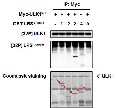 ULK1에 의한 LRS 인산화