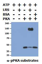 PKA에 의한 LRS phosphorylation 증가