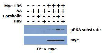 PKA에 의한 LRS phosphorylation 증가