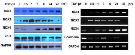 Differences in the EMT signaling pathway between TGF-β.