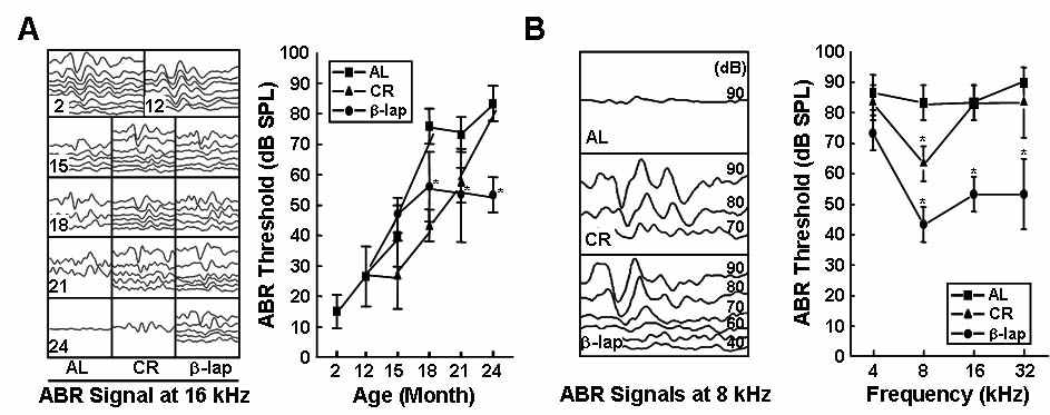 b-Lapachone (b-lap) improved age-related hearing loss in a mouse model.