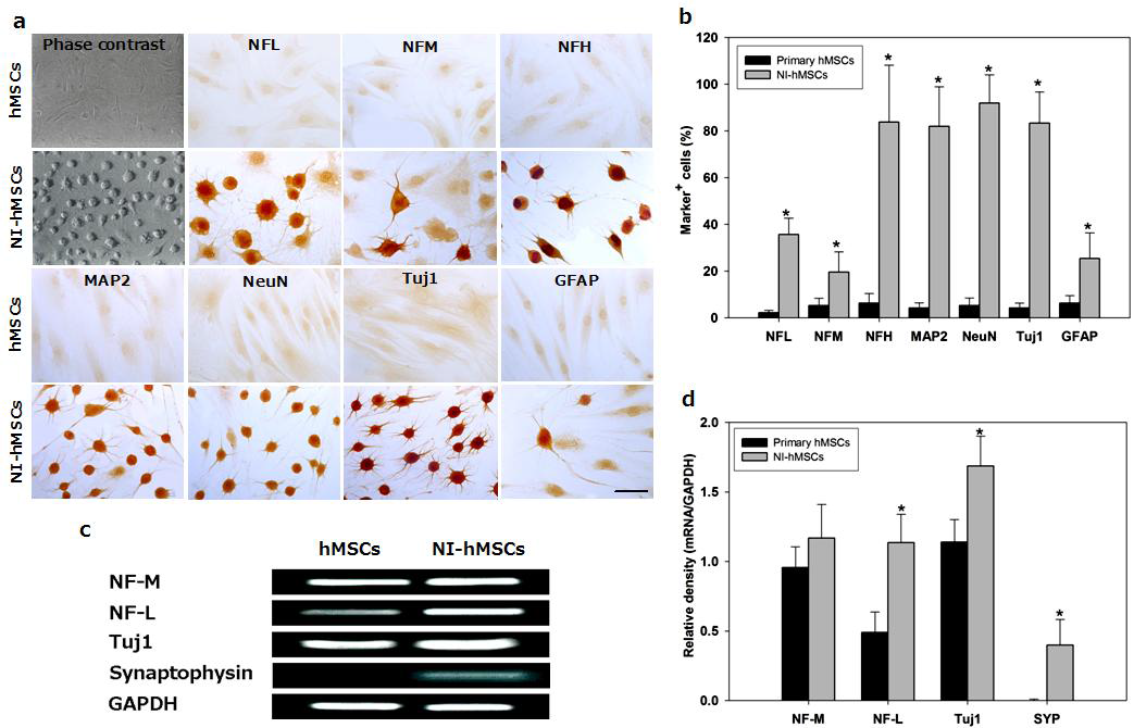 In vitro differentiation of hMSCs. Human MSCs were induced to differentiate into neural cells in the presence of bFGF and forskolin for 2 weeks.