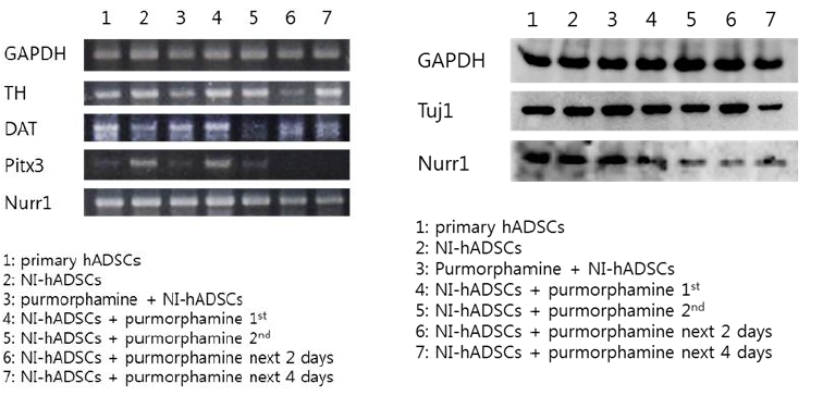 In vitro differentiation of hADSCs into dopaminergic neurons.