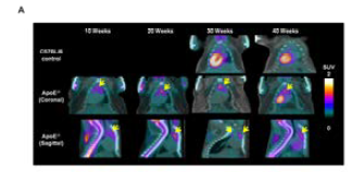 죽상경화증 모델에서 시간에 따른 18F-FDG의 PET/CT 영상