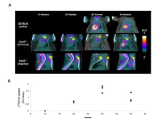 죽상경화증 모델에서 시간에 따른 18F-FDG의 PET/CT 영상