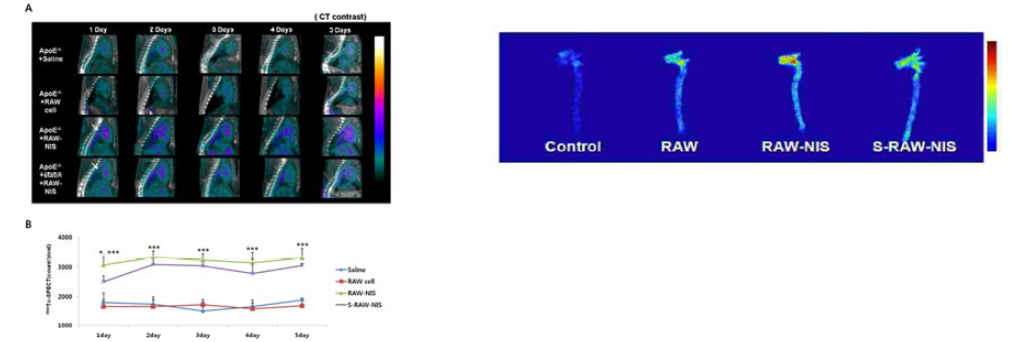 죽상경화증 모델에서 시간에 따른 Tc-99m의 SPET/CT 영상(좌) 및 영상을 획득 후 대동맥 적출 후 자가방사능측정법을 이용한 영상평가(우)