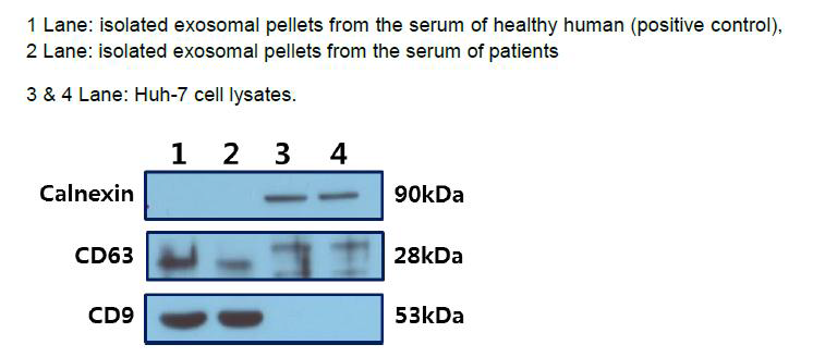 Expression of CD63, CD9 and calnexin by western blot analysis