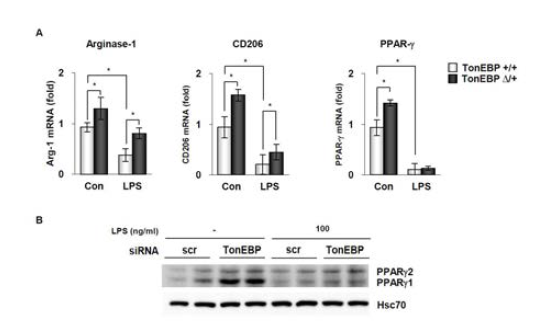TonEBP의 발현 감소에 의한 PPARγ와 항염증표지인자의 증가
