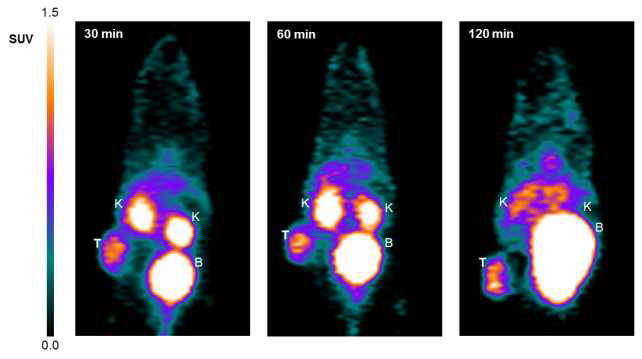 Micro-PET imaging (coronal) of malignant melanoma allograft mice after injection of [68Ga]Ga-NOTA-PCA (3)
