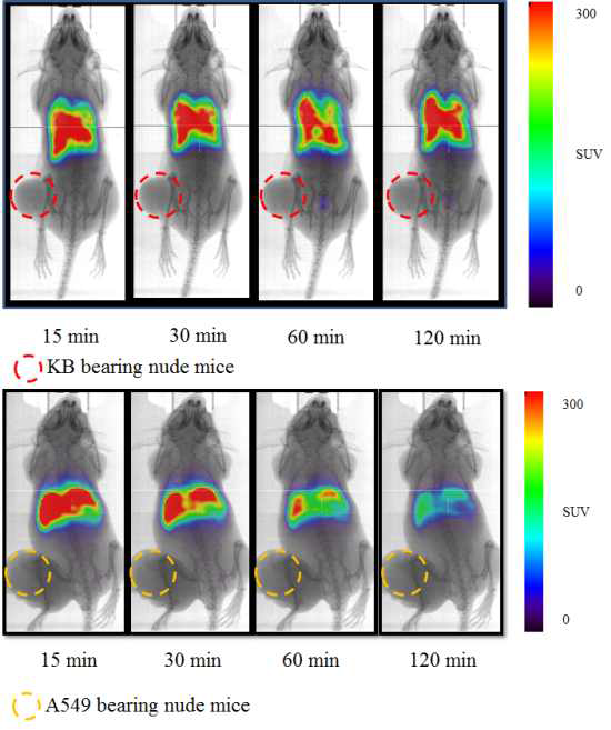 PET-images of 68GaN-FHFCNP [KB/A549]