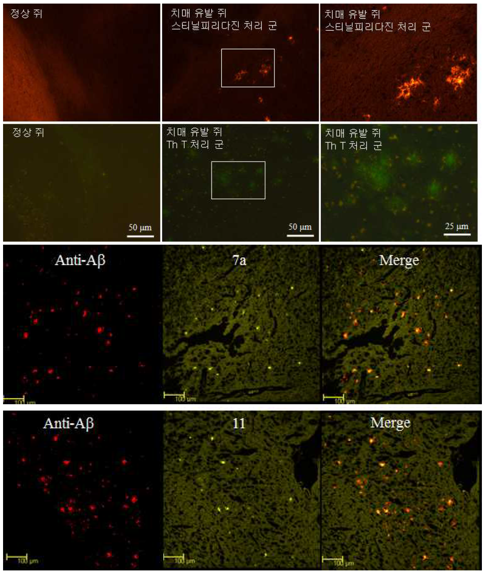 Histological double staining in transgenic mouse (APP/PS1) brain section