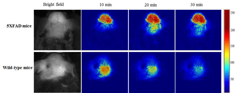 in vivo brain molecular imaging