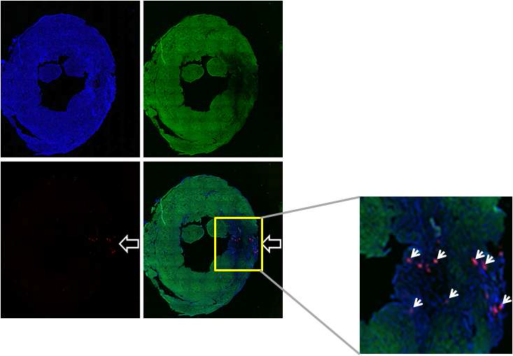 심근경색 유발 4주 후 이식한 세포의 잔류 확인