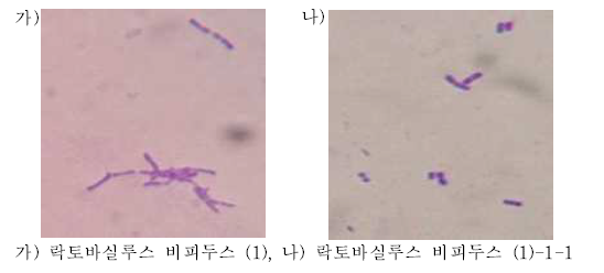 락토바실루스 비피두스의 단순염색