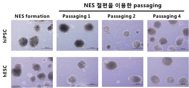 줄기세포의 NES 형성 및 passaging