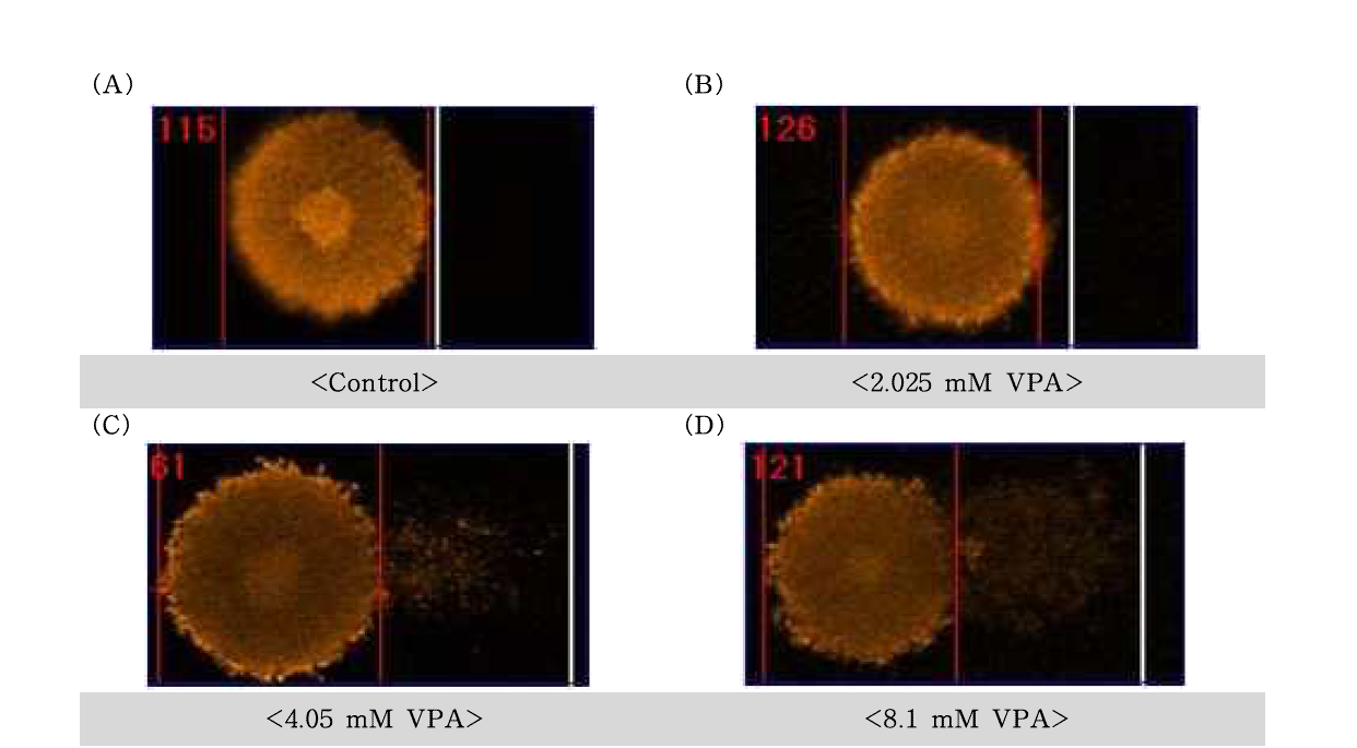 Valproic acid(VPA)에 대한 수컷 생식줄기세포의 comet image