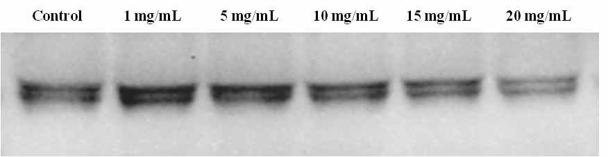 산화아연 100 nm 처리 후 plasma 내에 존재하는 β-actin의 발현양