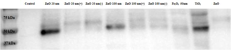 나노물질과 결합하는 coagulation factor 13 western blot 결과