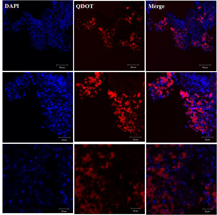 돼지 Gi tract에서 Quantum dot (CdTe)물질 노출 후 CLSM (Confocal laser sanning microspoes)으로 관찰 한 이미지