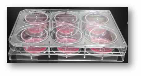 Transwell plate의 insert 부분에 Caco-2 cell seeding 한 사진